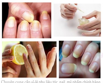 Móng tay của bạn có bị ố vàng không? hãy làm ngay các công thức này nhé